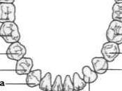 Alcune informazioni utili pericolosi denti devitalizzati