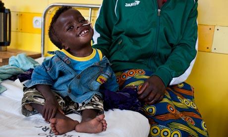 Patrick Mugisha is suffering from acute malnutrition manifesting in chronic wasting.