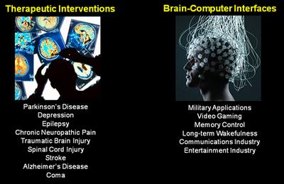 La DARPA vuole controllare il cervello dei soldati