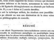 Sclerosi Multipla: CCSVI Zamboni scoperta trentasei anni