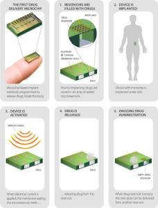 Il microchip sottocutaneo: il business medico sulla vita delle persone