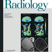 Sclerosi Multipla: da Napoli un interessante studio sul ruolo vascolare