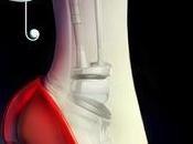 Anteprima, Cinder Cronache lunari, Marissa Meyer. Distopia, androidi amore questa fiaba cibernetica