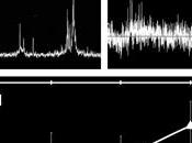 Scoperti alcuni vantaggi della dislessia