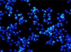 CELLULE STAMINALI: PERCHE’ SONO COSI’ IMPORTANTI