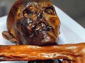 Oetzi, Etziu, mummia Similaun morto infezione