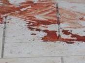 Crime News Milano: colpisce moglie martellate. donna grave