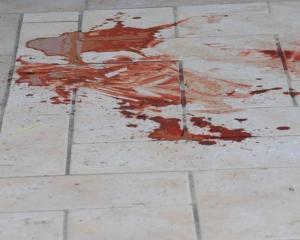 Crime News – Milano: colpisce la moglie a martellate. la donna è grave