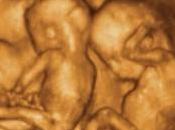 abortisti affanno osteggiano l’uso dell’ecografia