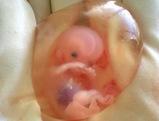 Bambini abortiti fatti pezzi venduti ricercatori tutta l’America