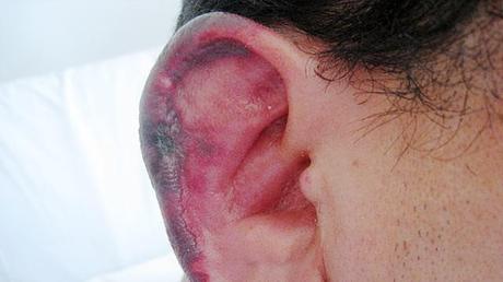PHOTO: The veterinary drug can rot the flesh of the nose and ears